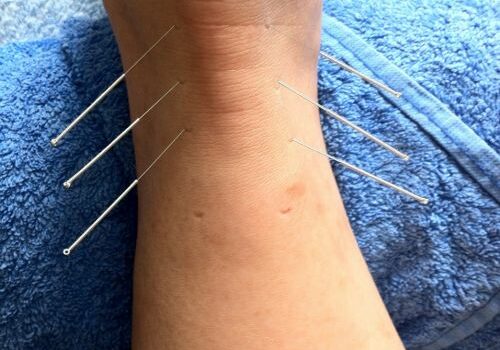 Chiropractor Kitchener