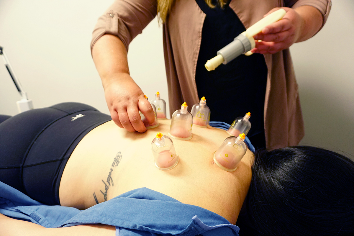 Cupping near me kitchener